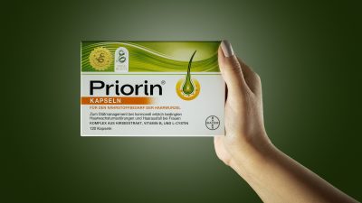 درمان ریزش مو بعد از زایمان