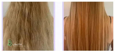 علت ریزش مو بعد از کراتین و راهکارهای درمان آن