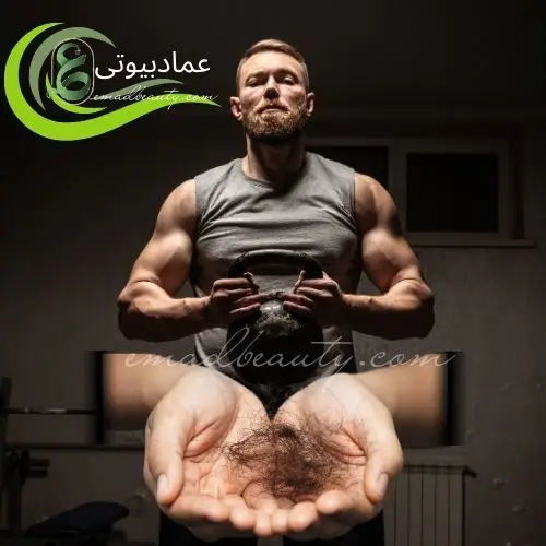 درمان ریزش مو در بدنسازی